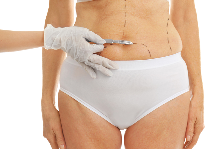 Body Contouring