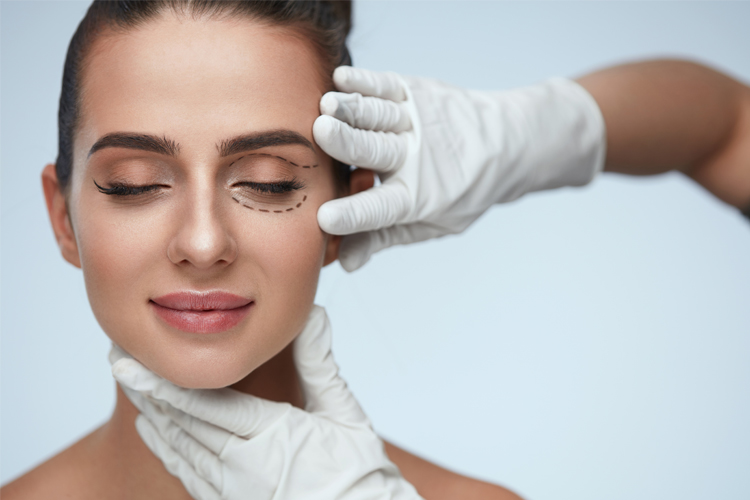 Eyelid Surgery