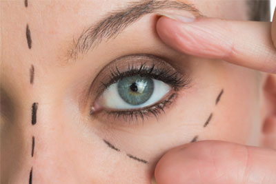 Eyelid Surgery