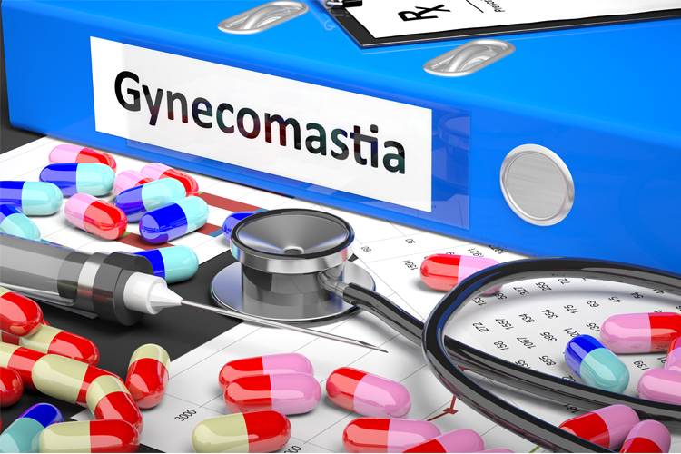 Gynecomastia